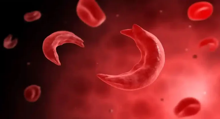 Sickle Cell Disease: राष्ट्रीय सिकल सेल एनीमिया उन्मूलन मिशन के तहत एक करोड़ से अधिक लोगों की जांच, जानें तीन सालों में मिशन का लक्ष्य